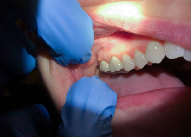 Best Tooth Pain Emergency Relief  in Lmdale, PA